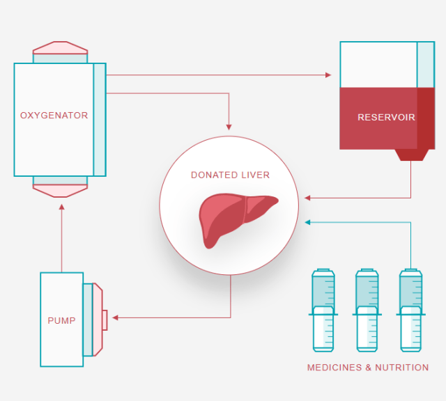 прибор трансплантологии