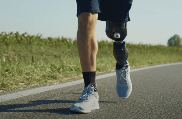 протез стоковое фото